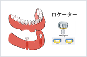 種類