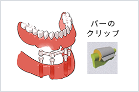種類